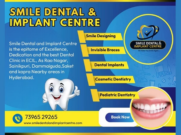 Smile Dental & Implant Centre announces Advanced Dental Care Services in A S Rao Nagar, Ecil Hyderabad