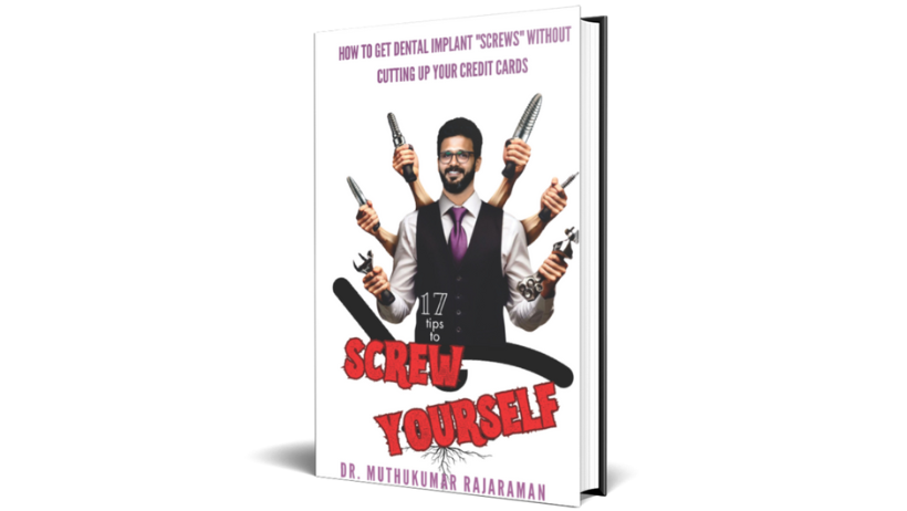 17 Tips to Screw Yourself – A Dentist's Ultimate Guide to Dental Implants Unveiled!